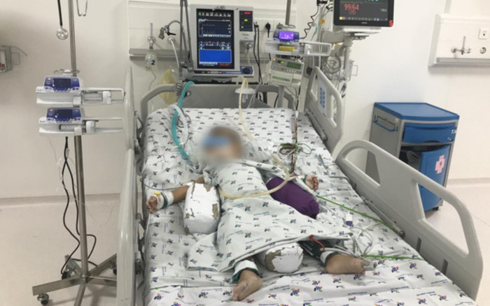 Bé 20 tháng tuổi gặp nguy vì nước hầm nấu cháo, các mẹ cần lưu ý khi nấu cháo cho con Ảnh 2