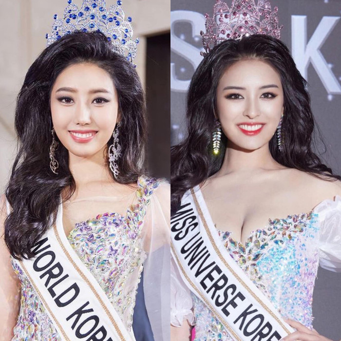 Miss Universe và Miss World Hàn Quốc như 2 giọt nước, fan tròn mắt: Thẩm mỹ cùng nhau sao? Ảnh 1