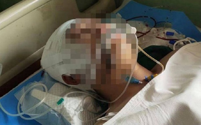 Phát hiện tin nhắn bị nói xấu, 2 thầy giáo đánh nam sinh đến... xuất huyết não Ảnh 2