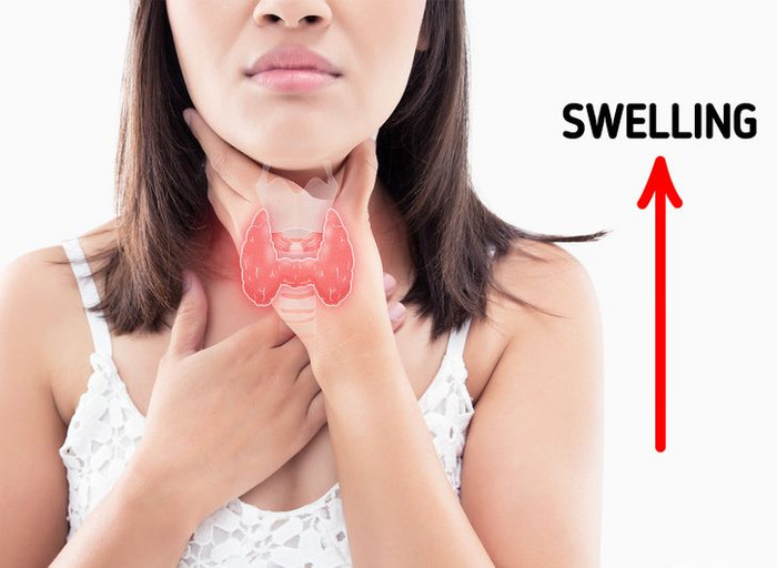 Cách đơn giản giúp bạn làm 'xẹp' khuôn mặt sưng húp vào sáng sớm Ảnh 8