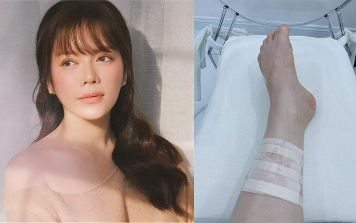 Lý Nhã Kỳ bị ngã bầm chân, mong tìm được người cõng Ảnh 2