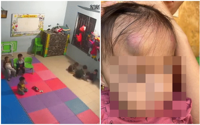 Vụ bé gái 2 tuổi bị bạn học đánh đạp dã man trong lớp học: Tạm đình chỉ hoạt động nhóm trẻ mầm non Vân Vũ Ảnh 2