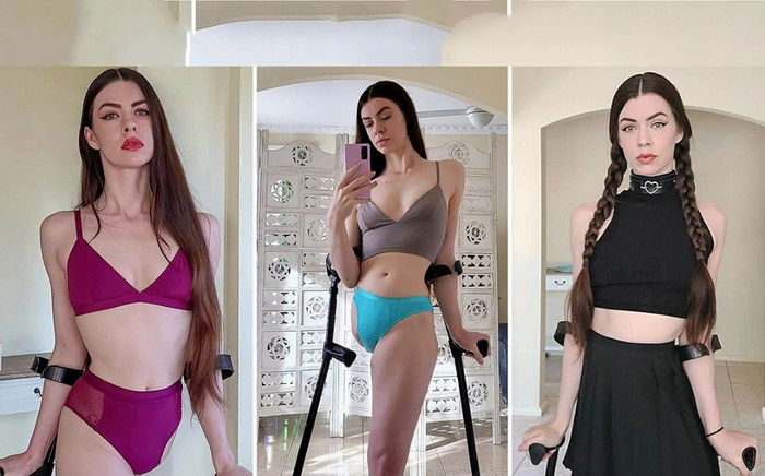 Cô gái mất chân trở thành người mẫu nổi tiếng và câu chuyện truyền cảm hứng Ảnh 2