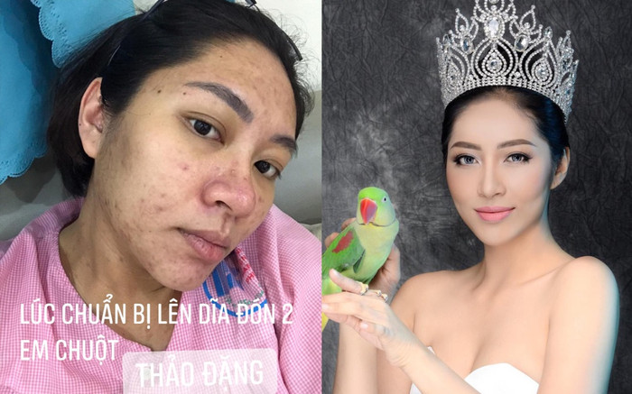 Nghị lực như Hoa hậu Đặng Thu Thảo: Từ nhan sắc bị mụn tàn phá khi mang bầu đến bản lĩnh trước đổ vỡ hôn Ảnh 2