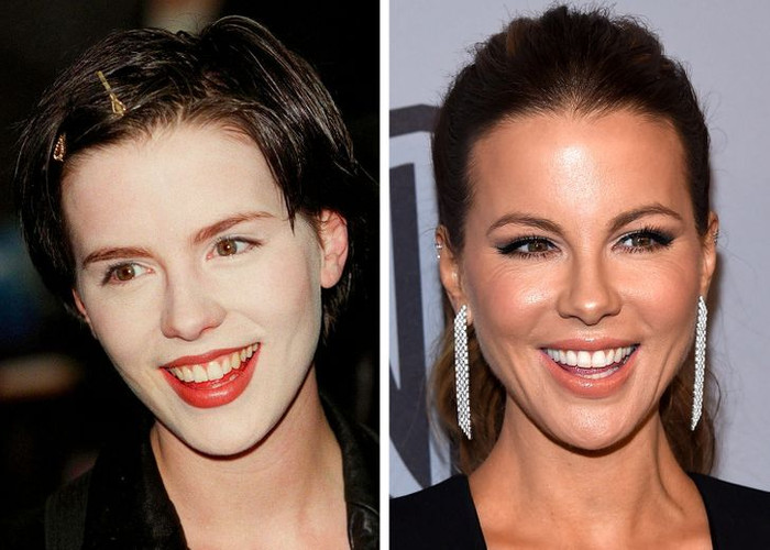 Trong quá khứ, Kate Beckinsale liên tục mắc lỗi trang điểm dùng phấn nền quá trắng. Sai lầm này khiến hàm răng ố vàng của cô càng nổi bật hơn. 