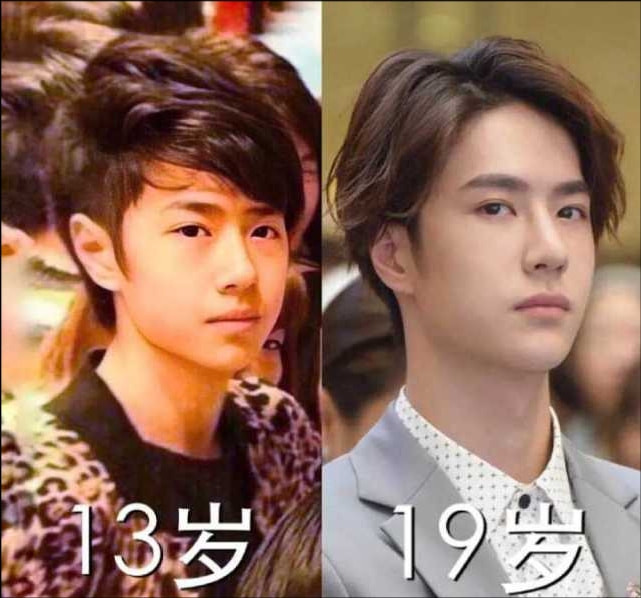 Chuyên gia phẫu thuật thẩm mỹ nói gì về dung mạo thật sự của Vương Nhất Bác và Tiêu Chiến? Ảnh 7