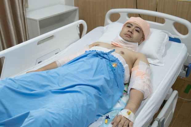 Akira Phan thời điểm đi hút mỡ.