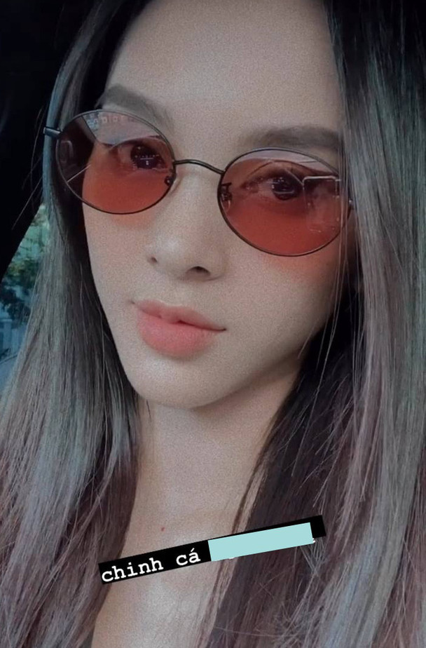 Karik đăng bàn tay đầy máu giữa lúc vướng nghi ngờ hẹn hò, phản ứng của Quỳnh Lương càng bất ngờ hơn Ảnh 4