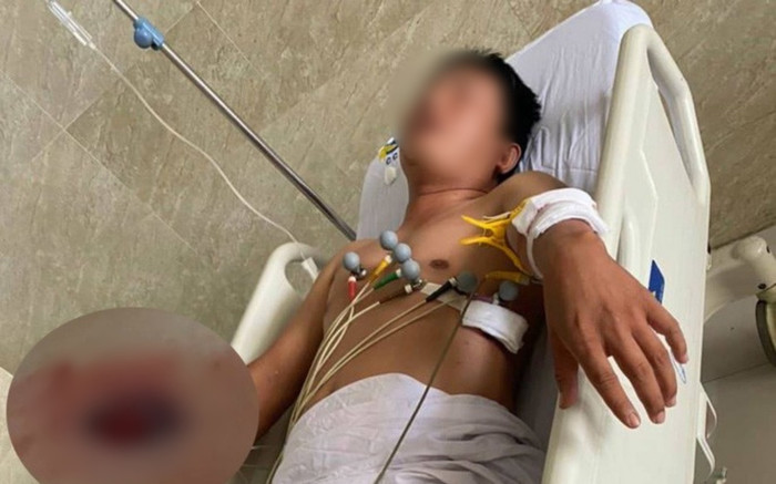 Đối phương bắn chỉ thiên, người đàn ông vẫn túm áo thách 'bắn đi' rồi nhập viện với 4 phát đạn Ảnh 2