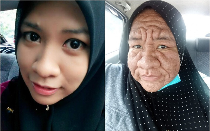 Tỉnh dậy sau một đêm, gái xinh bỗng hóa thành bà lão 70 tuổi, nguyên nhân khiến nhiều người ngỡ ngàng Ảnh 2