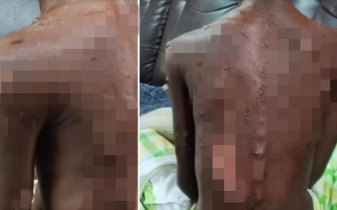 Sống với người cha nghiện ngập, hai đứa trẻ bị hành hạ dã man, vết thương trên người nhìn mà nhói lòng Ảnh 2