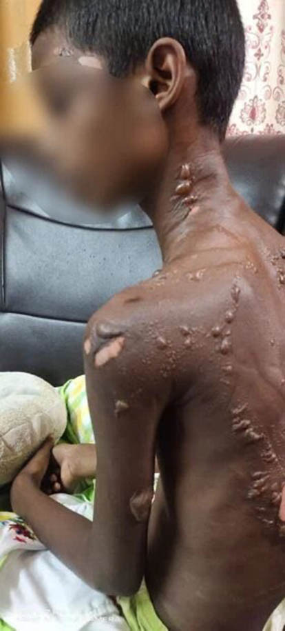 Sống với người cha nghiện ngập, hai đứa trẻ bị hành hạ dã man, vết thương trên người nhìn mà nhói lòng Ảnh 3