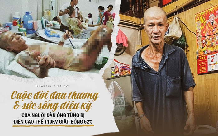Cuộc đời đau thương và sức sống diệu kỳ của người đàn ông từng bị điện cao thế 110Kv giật bỏng đến 62% Ảnh 2