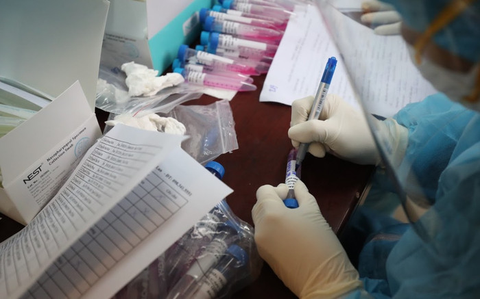 Hà Nội xây dựng kịch bản 100.000 F0, dự báo ca mắc Covid-19 tăng cao dịp Tết Ảnh 2