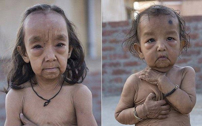 Hai chị em 7 và 18 tháng tuổi mang gương mặt già hơn cả cha mẹ, cuộc sống mỗi ngày gây xót xa Ảnh 2