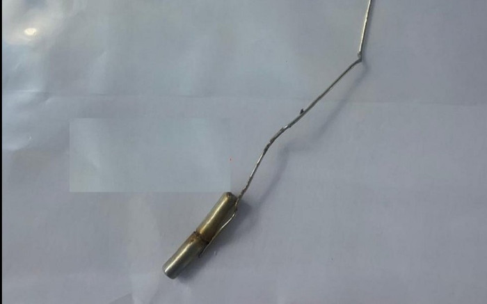 Bé trai 10 tuổi tự nhét thỏi nam châm và kẹp giấy vào dương vật Ảnh 2