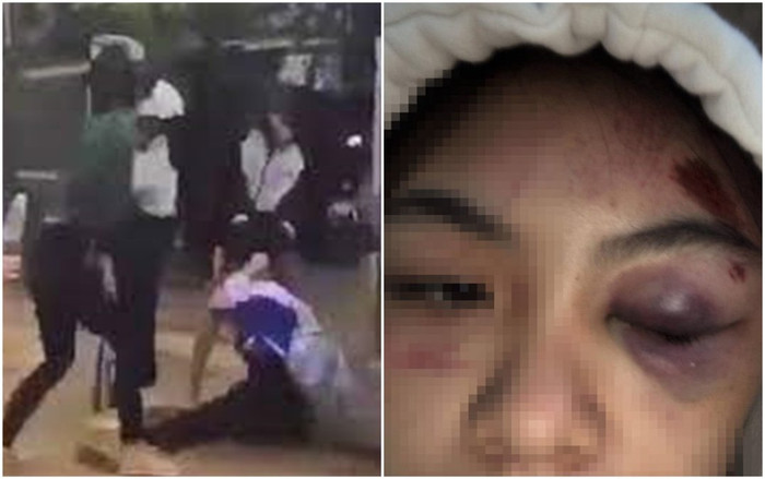 Nữ sinh lớp 11 ở Lâm Đồng bị nhóm người đánh hội đồng dã man, nằm gục tại chỗ Ảnh 2