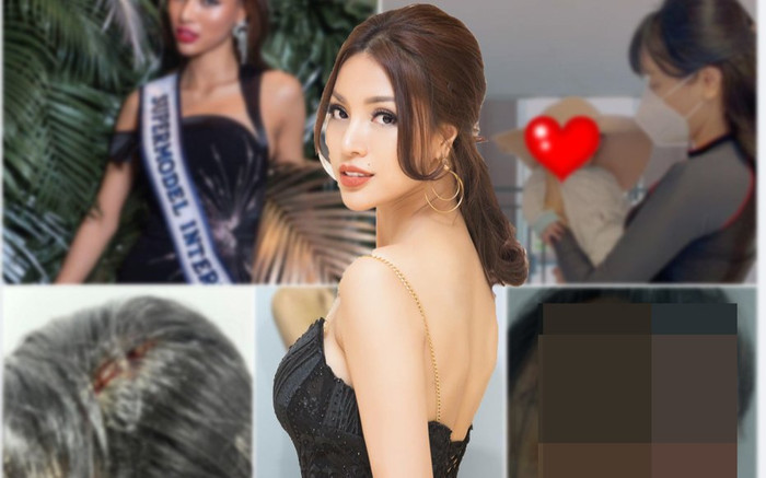 Một nữ siêu mẫu Vbiz bị chồng bạo hành như thời trung cổ, còn cắt tóc, dí đầu vào bồn cầu? Ảnh 2