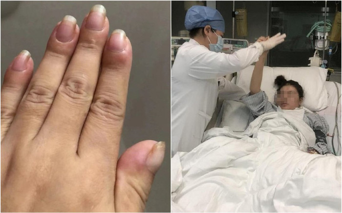 10 đầu ngón tay sưng to nhưng nửa năm không khám, người phụ nữ 'chết lặng' khi nghe kết luận của bác sĩ Ảnh 2