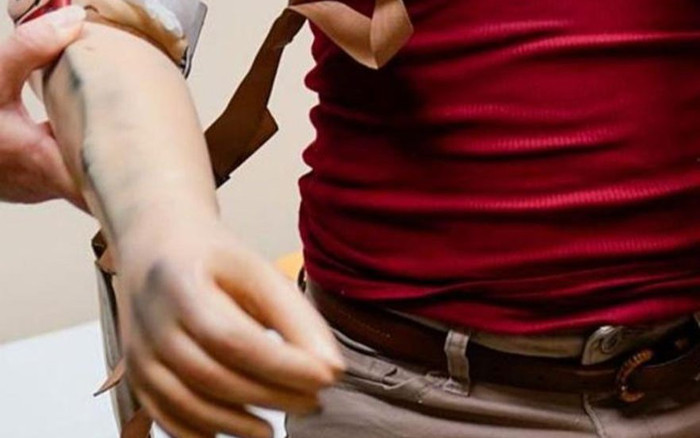 Dùng cánh tay giả để lừa nhân viên y tế tiêm vaccine Covid-19, người đàn ông nhận quả đắng Ảnh 2