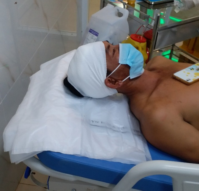Ông Nguyễn Văn Kế nhập viện với vết thương ở đầu.
