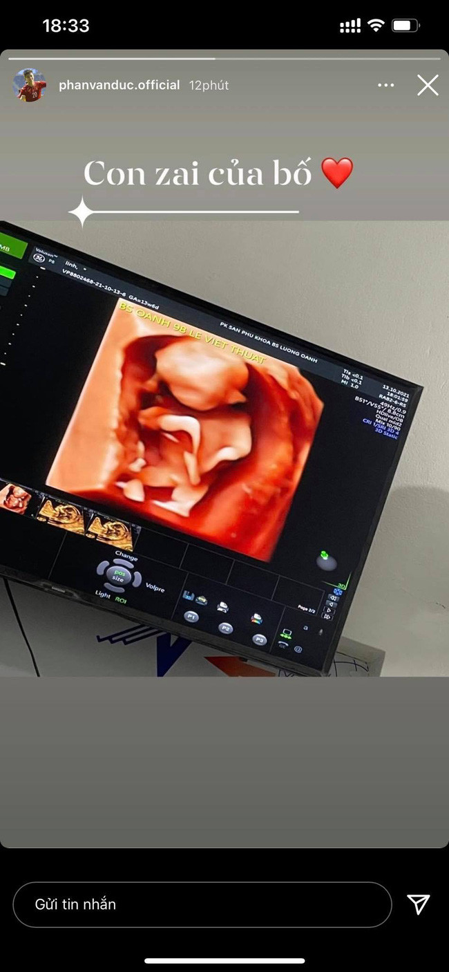 Cách đây hai tháng, Phan Văn Đức thông báo sắp đón con trai.