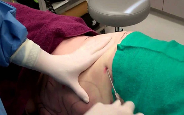 Người phụ nữ 31 tuổi ở TP.HCM tử vong sau khi hút mỡ bụng tại một spa Ảnh 2