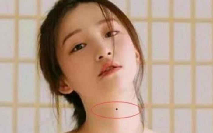 3 nốt ruồi 'biến nguy thành an', ai có được thì cả đời thuận lợi an nhàn, không cần lo lắng về tiền bạc Ảnh 2