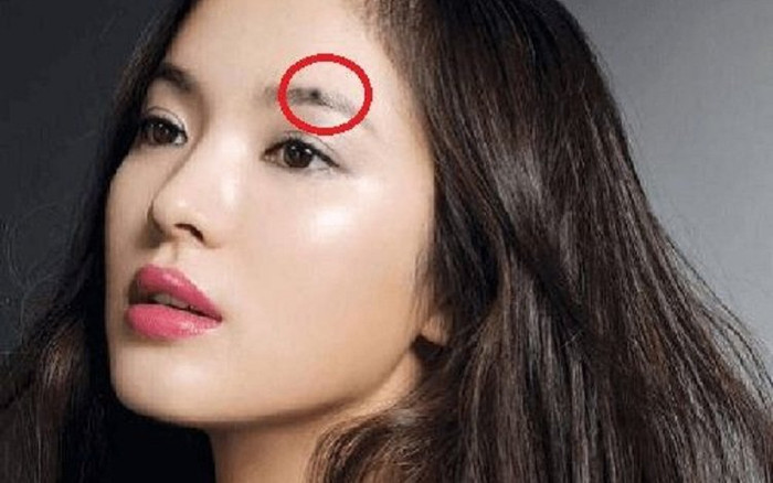 Ai sở hữu nốt ruồi ở 3 vị trí này là hóa thân của Bồ tát, làm ăn ắt phát tài phát lộc Ảnh 2