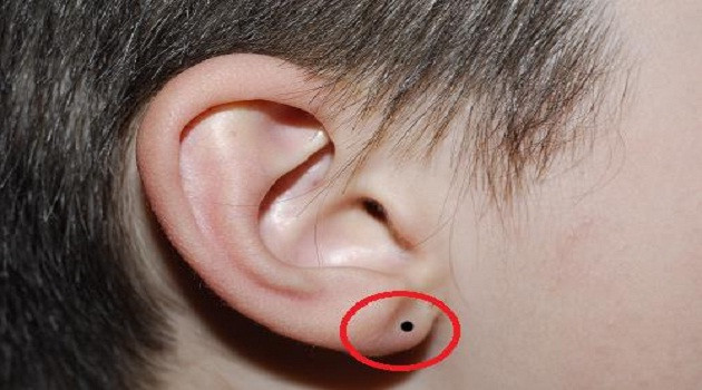 Nốt ruồi ở dái tai được coi là nốt ruồi may mắn, mang lại nhiều phúc khí cho chủ nhân của nó.
