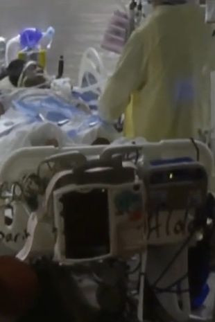 Nhiễm Covid-19 khi chưa được tiêm phòng, người phụ nữ bị cắt cụt tứ chi Ảnh 4