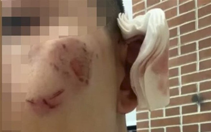 Thanh niên bỗng dưng bị chặn lại đánh ghen nhầm vì 'tưởng là người yêu mới của bạn gái cũ' Ảnh 2