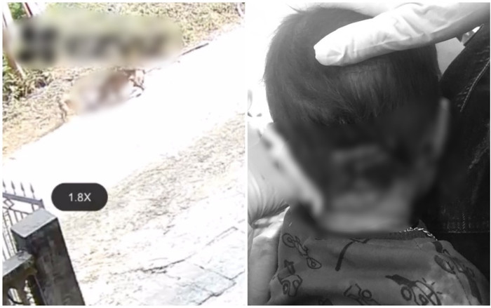 Vụ bé trai 2 tuổi bị chó dữ tấn công kinh hoàng: Trên cơ thể có nhiều vết thương, phẫu thuật gấp Ảnh 2