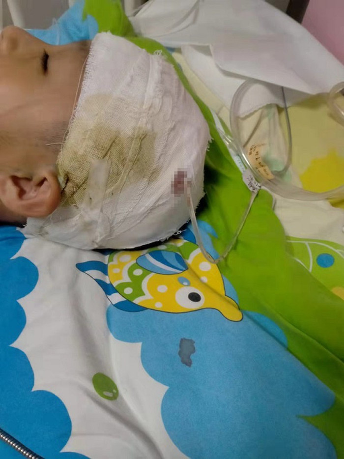 Cậu bé 10 tuổi nhập viện sau khi bị thầy Hiệu trưởng đánh. Ảnh: The Paper 