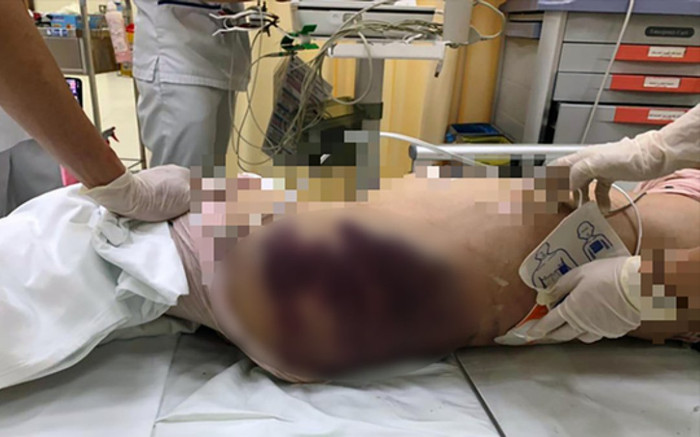 Bé gái 8 tuổi tử vong nghi do 'mẹ kế' bạo hành Ảnh 2