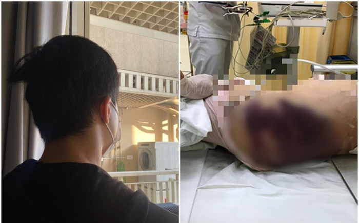 Bé gái nghi bị 'mẹ kế' đánh tử vong: Lời kể ám ảnh của hàng xóm về tiếng la hét bất lực của nạn nhân Ảnh 2