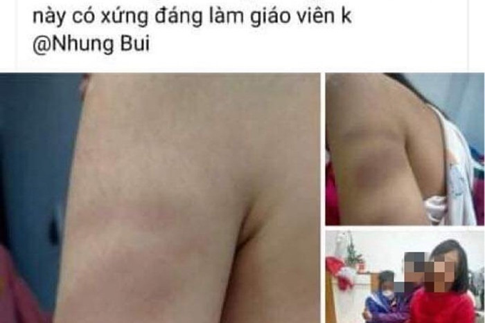 Bài đăng tố cô giáo đánh học sinh gây xôn xao mạng xã hội