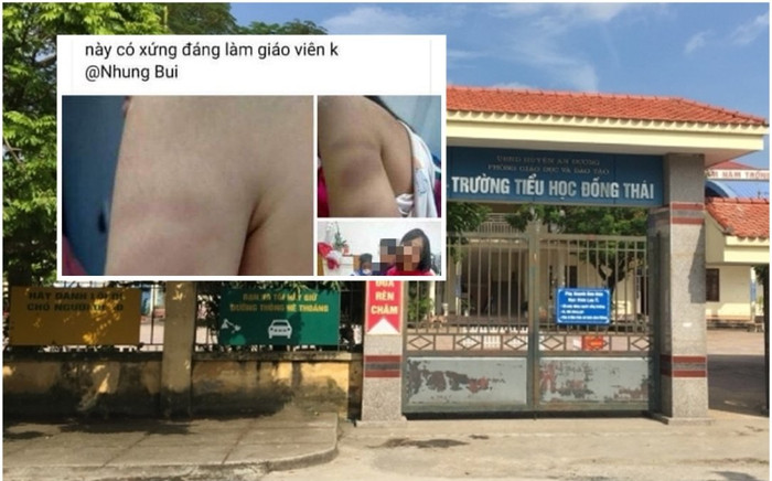 Dùng thước đánh tím tay học sinh lớp 1, cô giáo ở Hải Phòng bị đình chỉ dạy học một tuần Ảnh 2