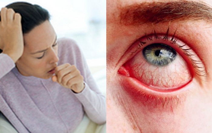 Thêm hai triệu chứng của người nhiễm biến chủng Omicron liên quan tới tóc và mắt Ảnh 2