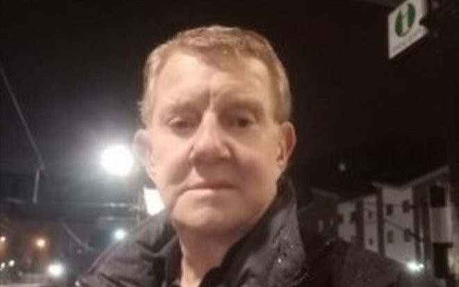 Phẫu thuật chữa má sưng húp, cụ ông 'tá hoả' vì không thể nhắm mắt ngủ suốt 3 năm Ảnh 2