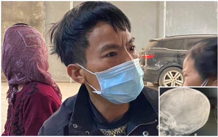 Bố bé gái 3 tuổi nghi bị bạo hành bật khóc khi nhắc đến con: 'Tôi không biết phải làm gì lúc này' Ảnh 2