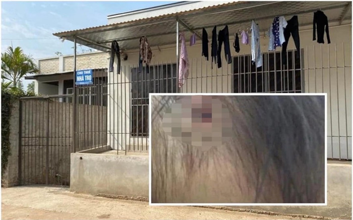 Hình ảnh được cho là của bé gái 3 tuổi ở Hà Nội với chiếc đinh găm thẳng vào đầu gây xôn xao MXH Ảnh 2