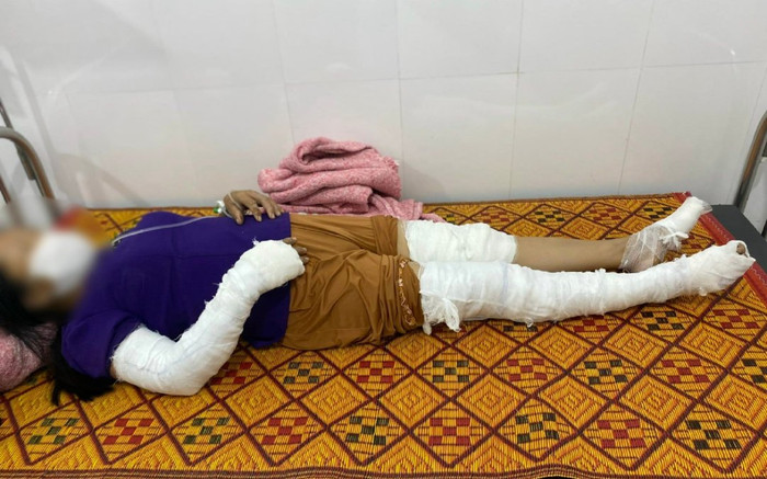 Nghệ An: Dựng cây nêu, 3 người bị điện giật Ảnh 2