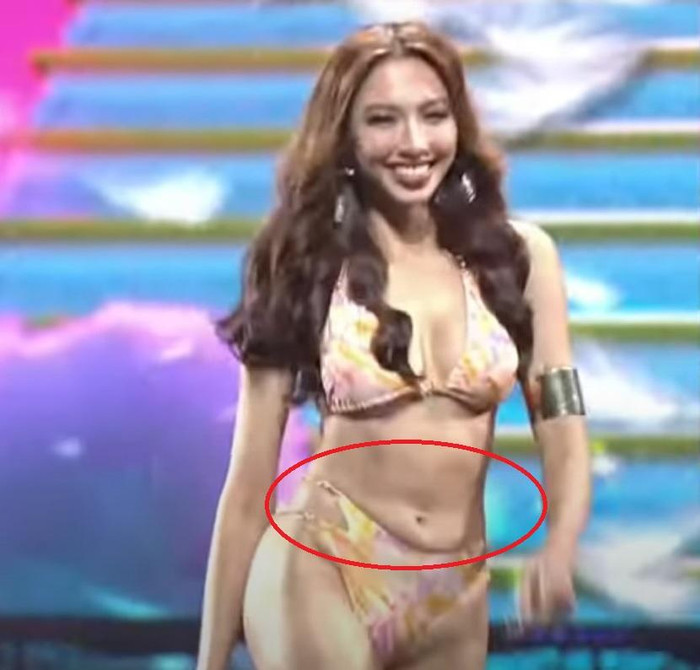 Phần mỡ bụng này thậm chí còn 'tràn' ra ngoài.