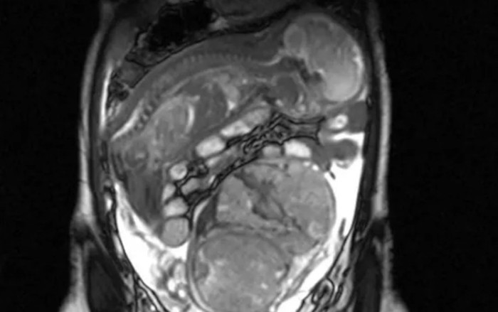 Lén phá thai, người phụ nữ 40 tuổi 'choáng váng' với hình ảnh siêu âm Ảnh 2