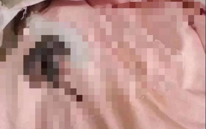 Trở lại phòng trọ sau kỳ nghỉ Tết, té xỉu vì 'vị khách lạ' xuất hiện trên giường Ảnh 2