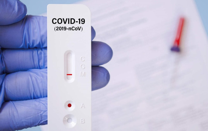 Bác sĩ khuyến cáo test nhanh Covid-19 âm tính nhưng vẫn cần cách ly nếu có những dấu hiệu này Ảnh 2