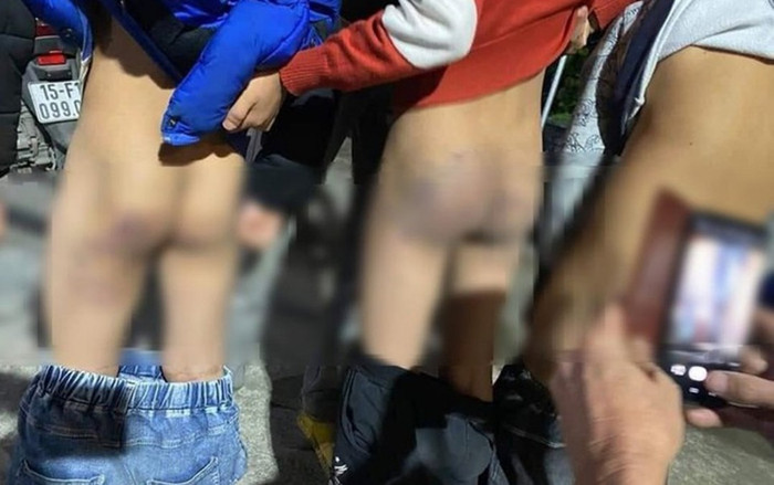 Vụ 3 học sinh bị đánh bầm mông vì không hoàn thành bài tập về nhà: Cô chủ nhiệm bị chấm dứt hợp đồng Ảnh 2