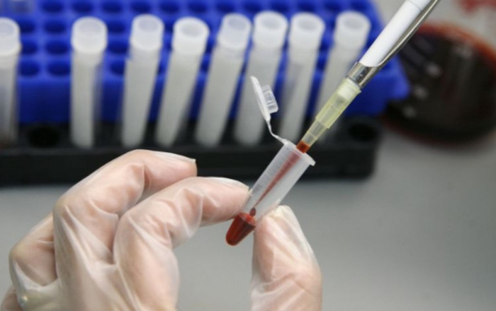 Người phụ nữ đầu tiên trên thế giới được chữa khỏi HIV bằng phương pháp cấy ghép tế bào gốc Ảnh 2