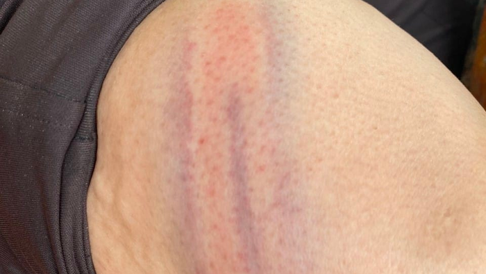 Vụ nhóm phụ nữ chỉ mặc áo ngực bị kéo lê ở công trường: Nguyên nhân do mâu thuẫn tranh chấp đất đai Ảnh 2